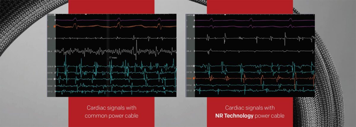 nr_v2_cardiac_signals_comparison_1200x431.jpg